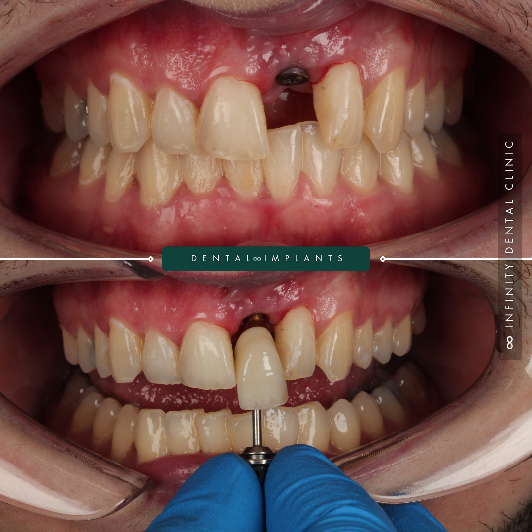 2-Mar-28-2025-10-28-28-1675-AM