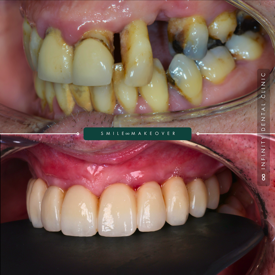 3-Mar-28-2025-10-28-28-1713-AM