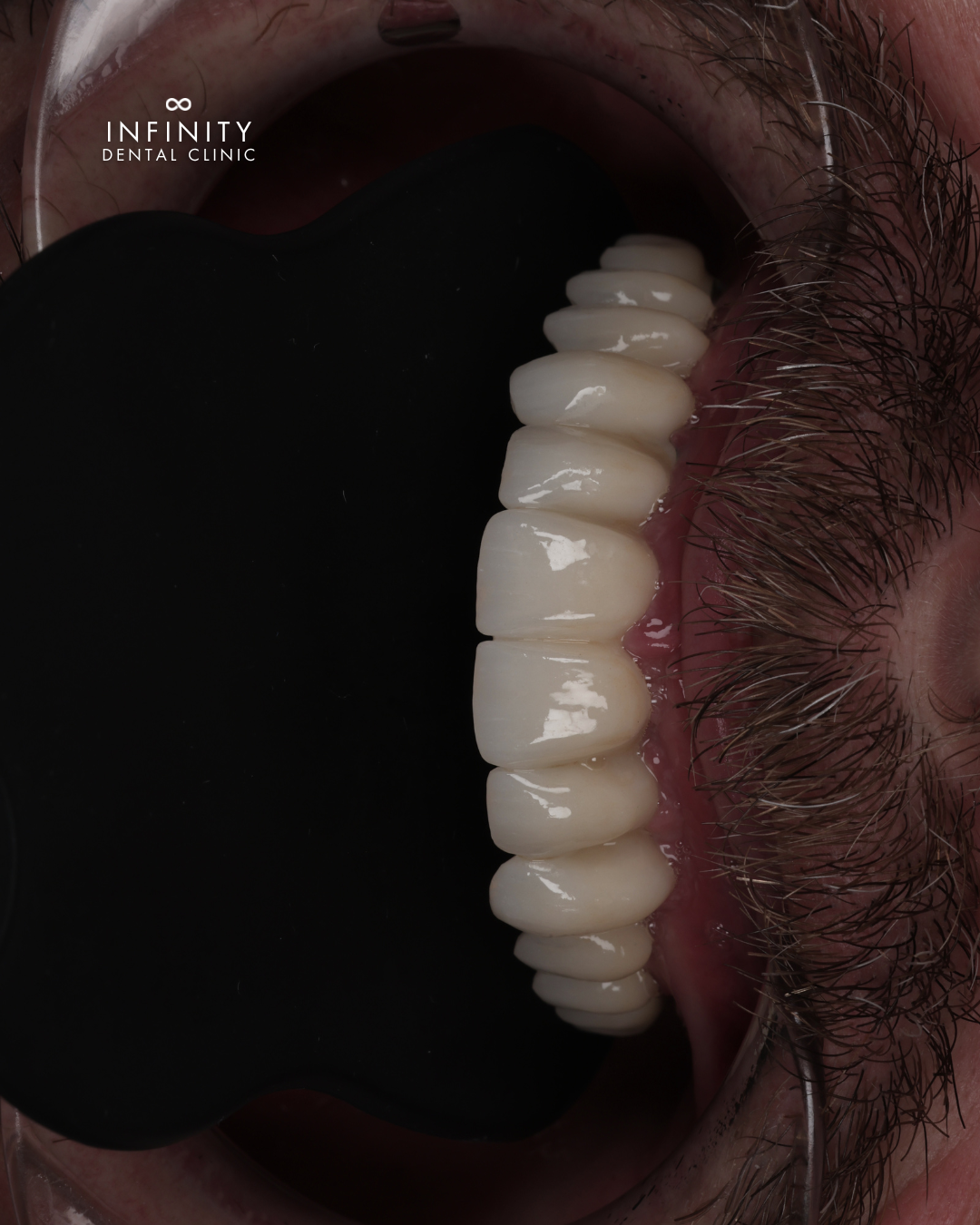 Creating beautiful smiles (13)