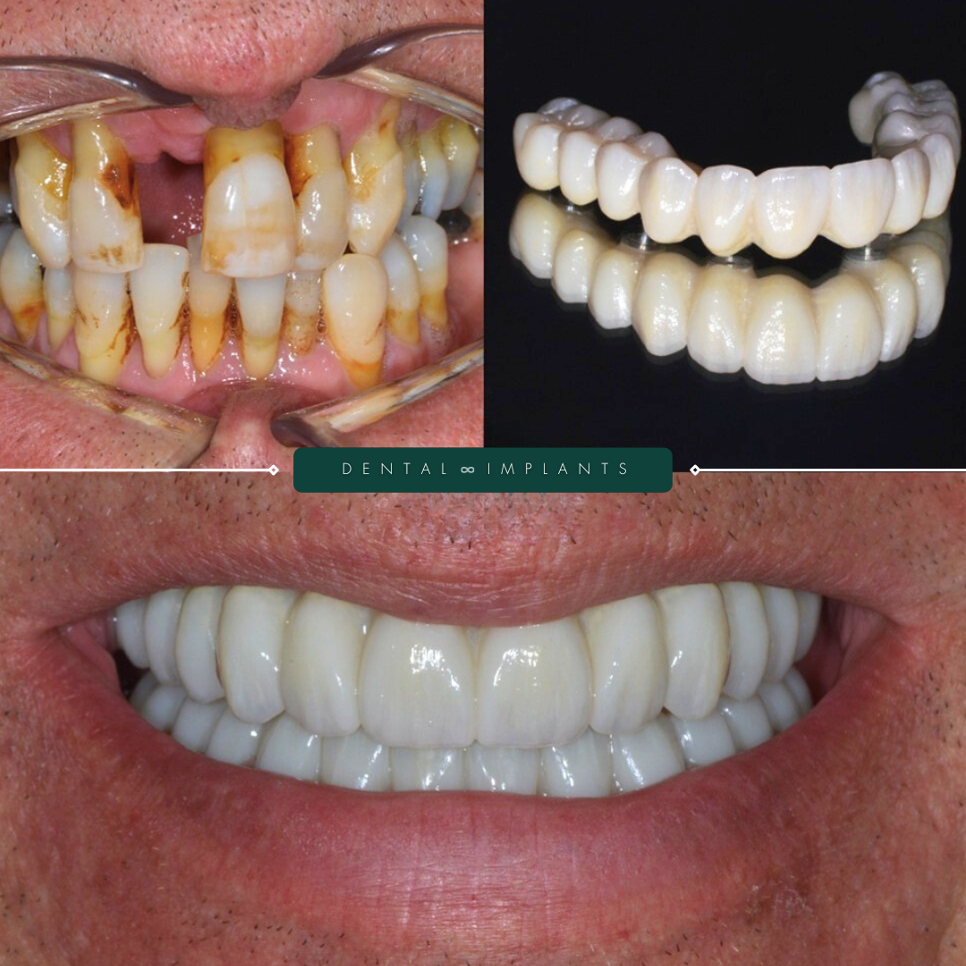 TEETH TRANSFORMATIONS - 2025-02-24T120640.081 TEETH TRANSFORMATIONS - 2025-02-24T120640.081