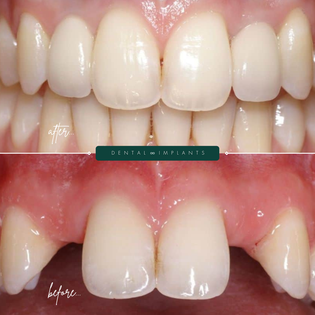 TEETH TRANSFORMATIONS - 2025-02-24T134616.763 TEETH TRANSFORMATIONS - 2025-02-24T134616.763