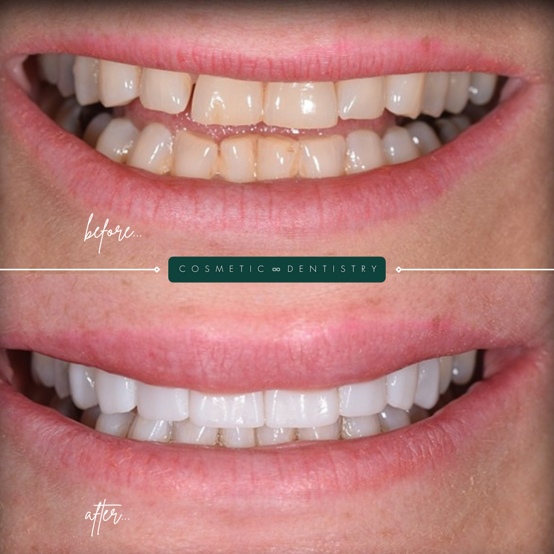 TEETH TRANSFORMATIONS - 2025-02-25T110739.360-1