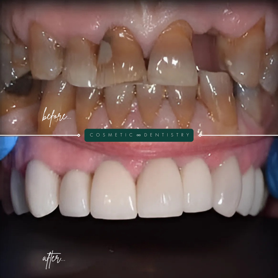TEETH TRANSFORMATIONS - 2025-02-25T114356.019