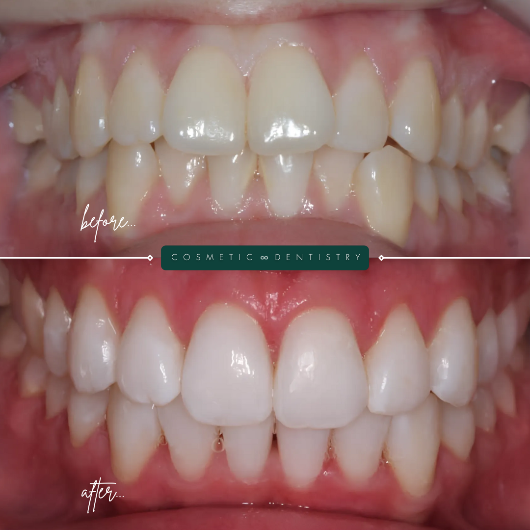 TEETH TRANSFORMATIONS - 2025-02-25T123527.771-1 TEETH TRANSFORMATIONS - 2025-02-25T123527.771-1