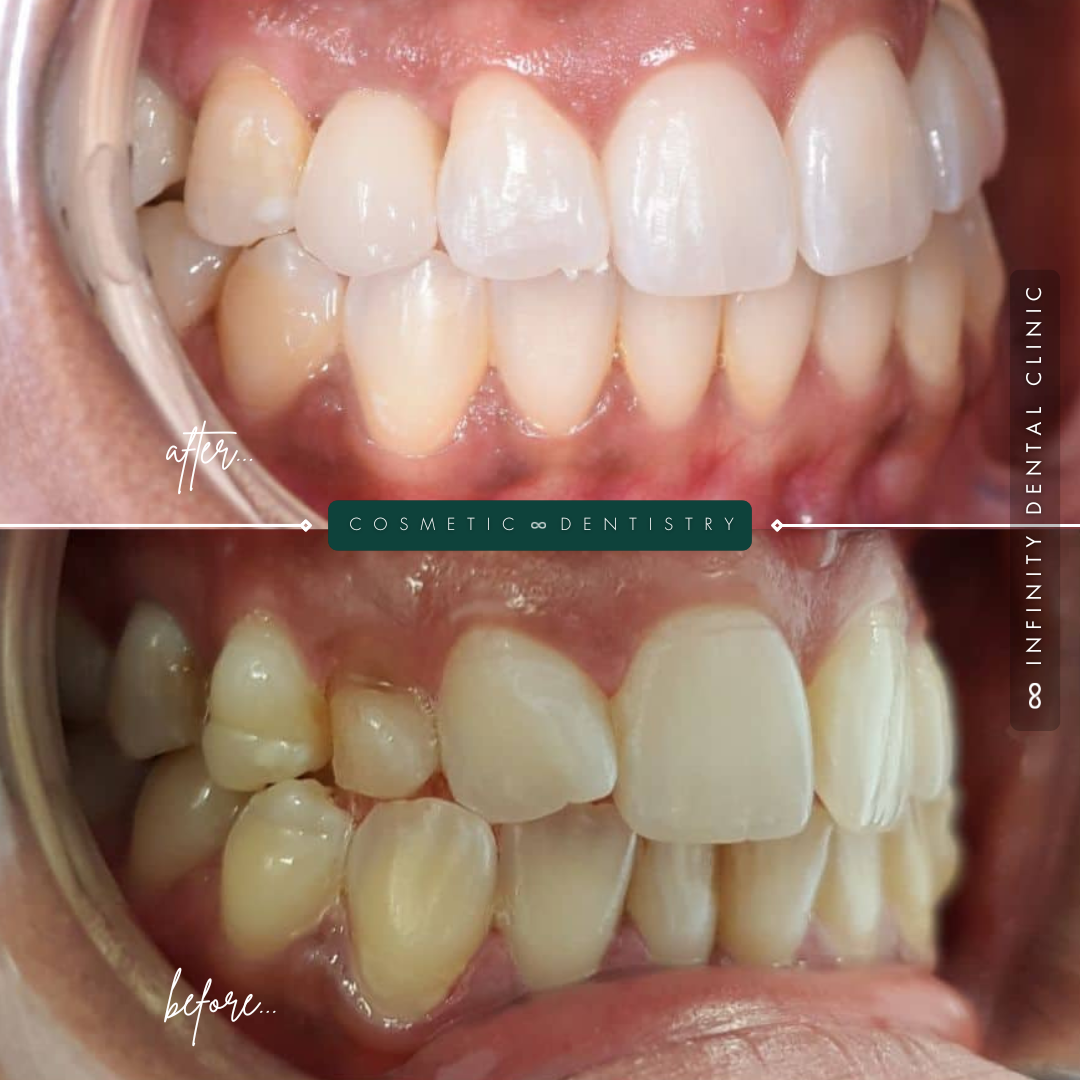 TEETH TRANSFORMATIONS - 2025-03-13T114659.955
