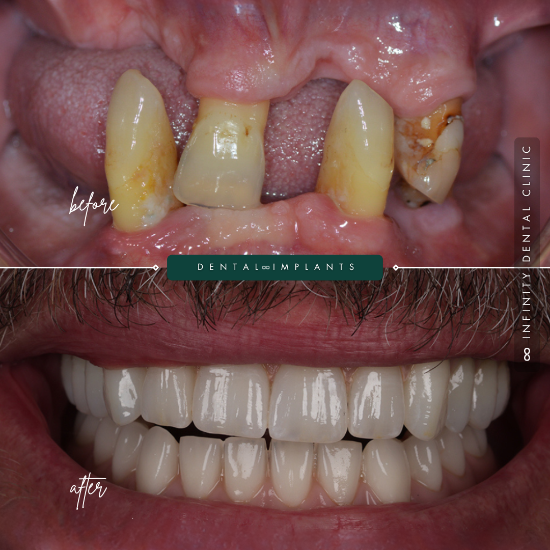 TEETH TRANSFORMATIONS - 2025-03-28T102931.350
