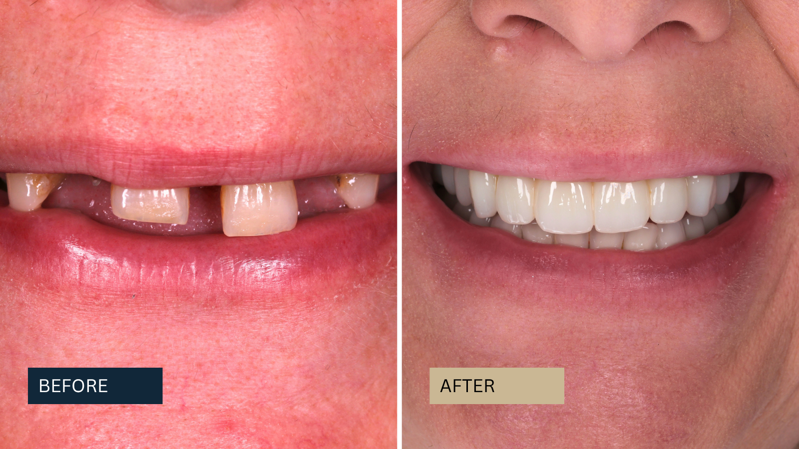 Before and after patient transformation
