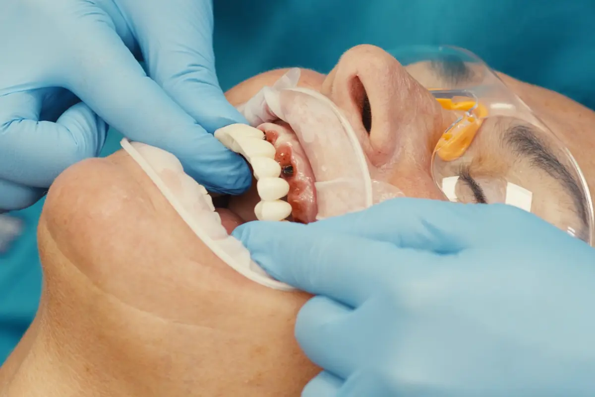 Placeholder image for same day teeth treatment